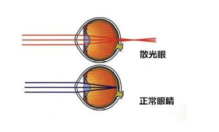 如何判断孩子眼睛是不是散光