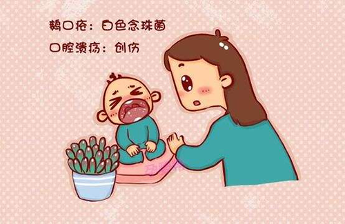 宝宝长鹅口疮不过妈妈们也不用太过担心